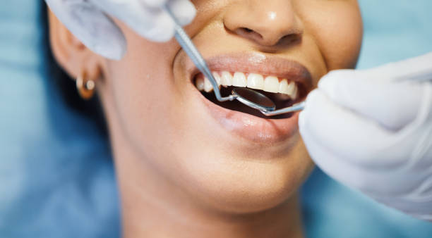 Best Emergency Dental Care for Abscessed Tooth in Silver Hill, MD