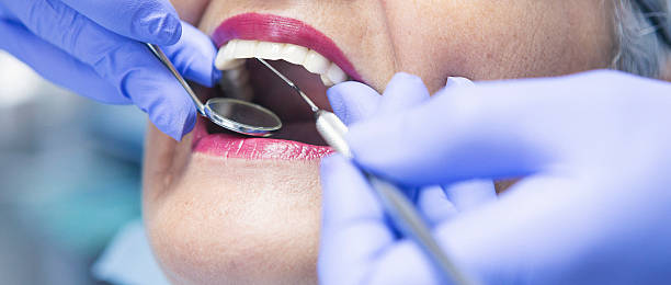 Best Emergency Dentist for Special Needs Patients in Silver Hill, MD